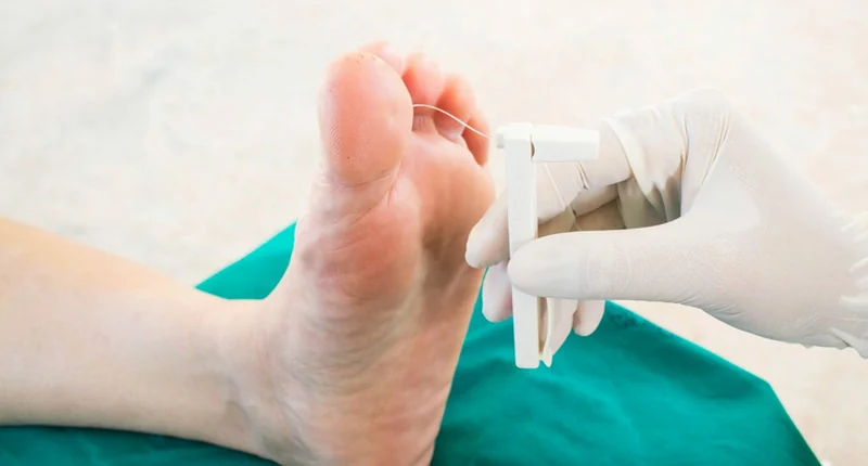 Launch a Rewarding Career as a Diabetic Foot Technician: A Comprehensive Guide