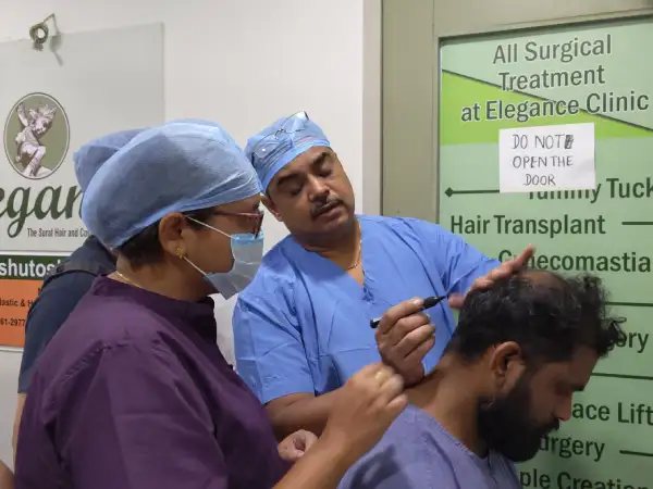 hair-transplant