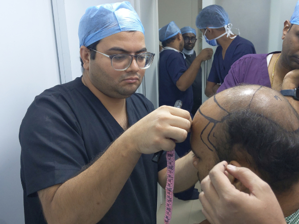 Hair restoration treatment in Surat Gujarat India