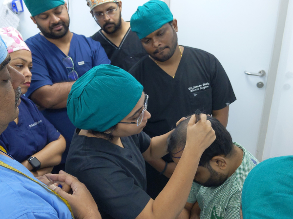 Best hair transplant in Piplod Surat