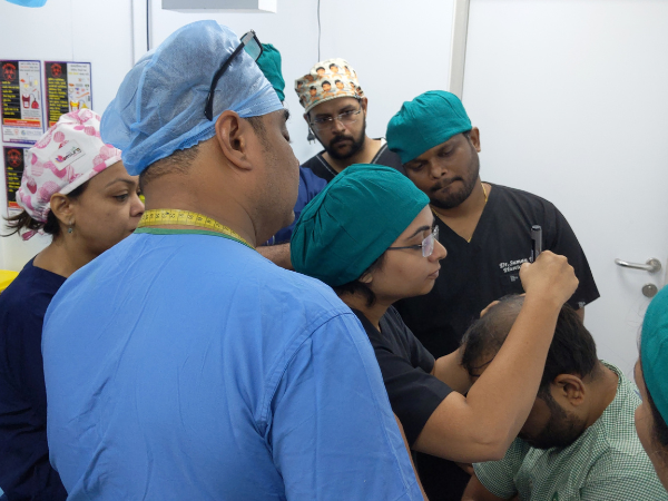 Hair transplant clinic in Katargam Surat