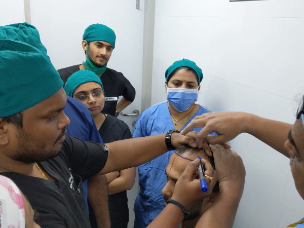 Expert hair transplant surgeon in Katargam Surat