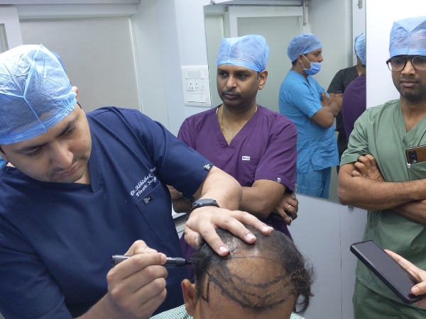 Safe hair transplant treatment in Surat Gujarat