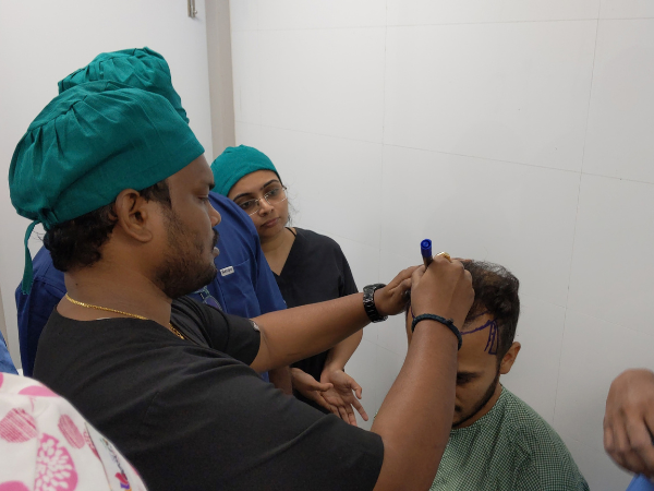 Advanced hair transplant in Athwa Surat