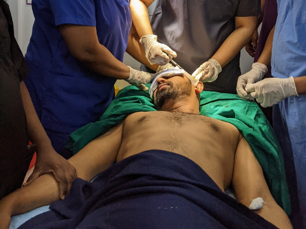 Hair transplant clinic in Surat Gujarat with advanced technology