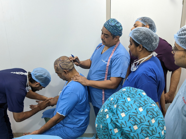 Hair transplant clinic near Vesu and Piplod Surat