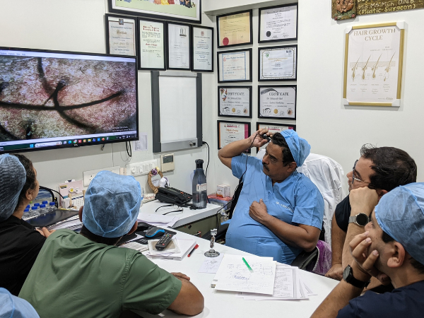 Reliable hair transplant treatment in Surat