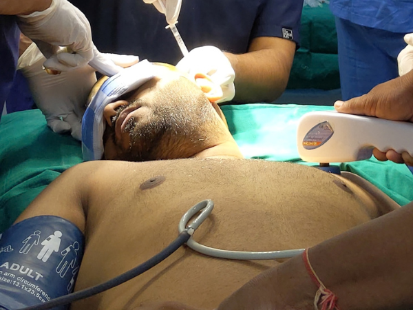 Hair transplant near me in Katargam Surat