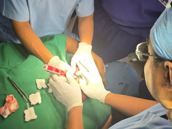 fue-hair-transplant-graft-implantation-recipient-site-close-up