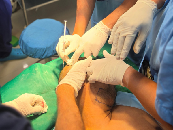 fue-hair-transplant-live-surgery-training-operation-theatre