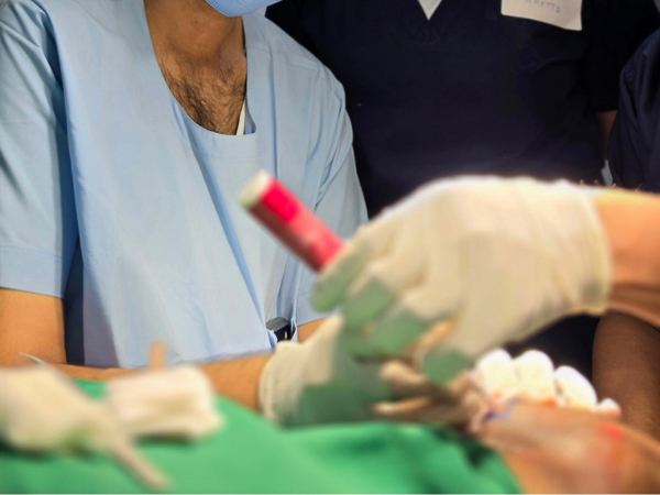 hair-graft-implantation-pen-closeup-technique