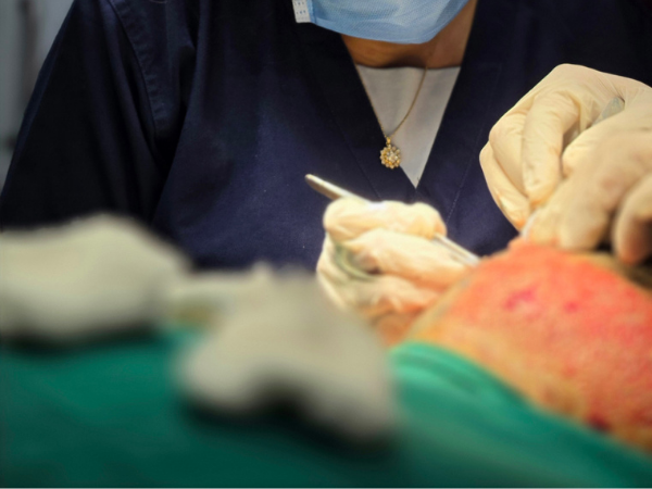 hair-graft-placement-closeup-workshop-training