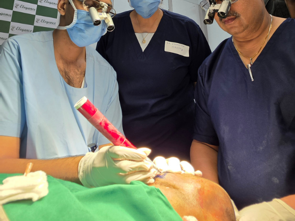 hair-restoration-implantation-pen-live-demonstration