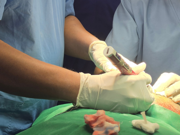 hair-restoration-implantation-technique-closeup