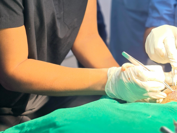 hair-restoration-surgeon-hair-transplant-training-workshop