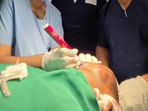hair-restoration-surgeon-patient-procedure-session