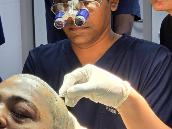 hair-transplant-graft-implantation-implanter-pen-recipient-site