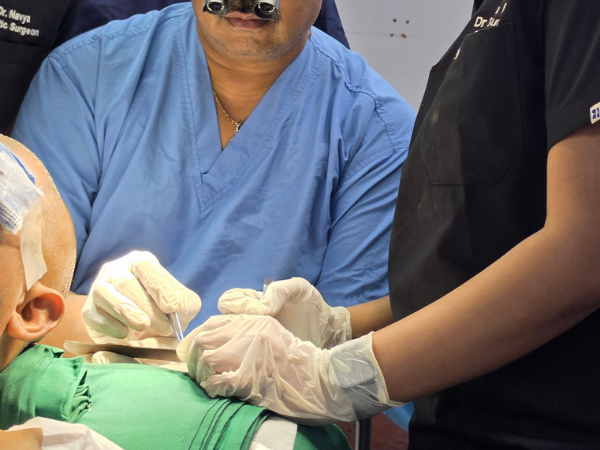 hair-transplant-graft-implantation-loupes-hands-on-session
