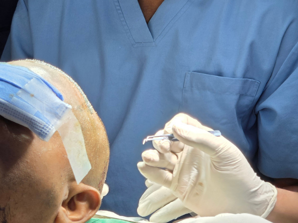 hair-transplant-graft-implantation-recipient-site-hands-on