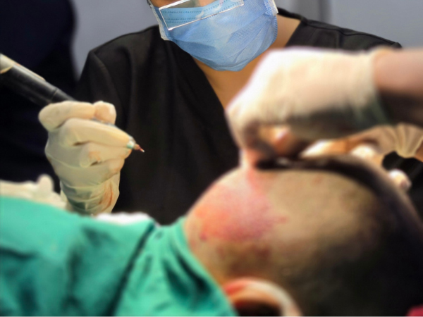 hair-transplant-graft-placement-live-workshop
