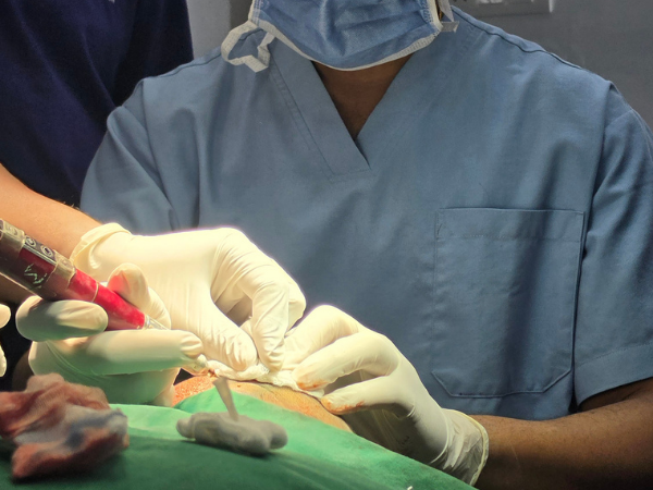 hair-transplant-graft-placement-practical