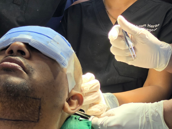 hair-transplant-implanter-pen-graft-implantation-close-up