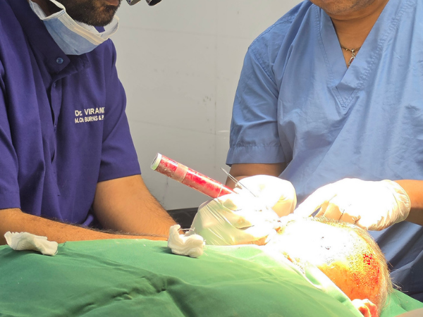 hair-transplant-implanter-pen-graft-placement-hands-on-training