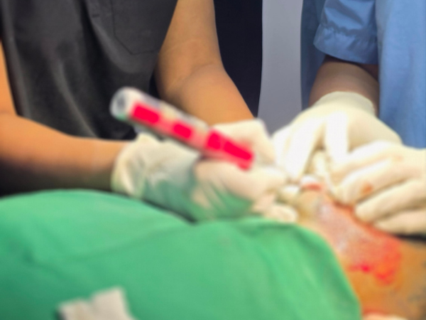 hair-transplant-implanter-pen-technique-training-close-up