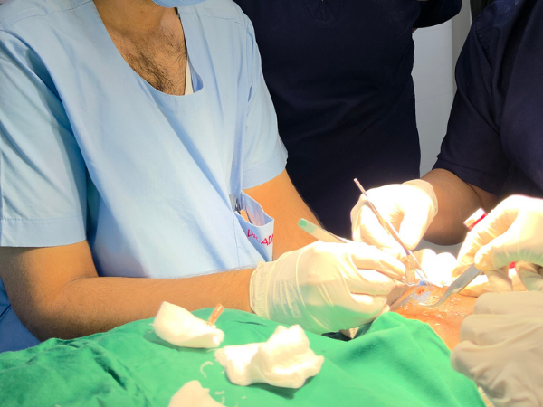 hair-transplant-live-surgical-team-training