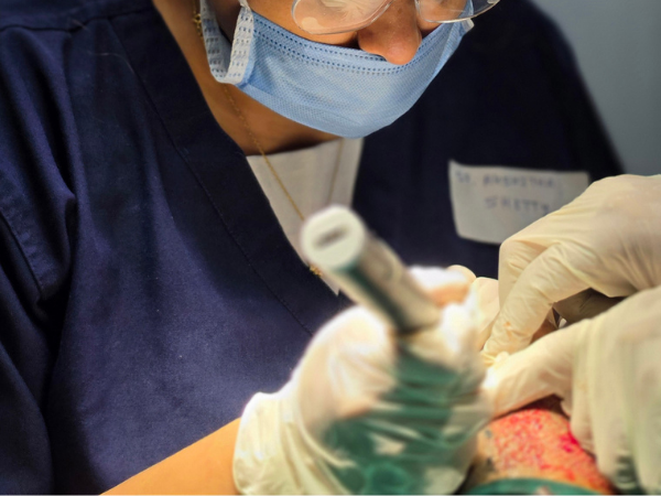 hair-transplant-recipient-site-closeup-practice