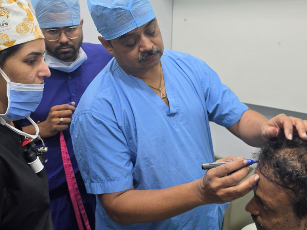 hair-transplant-scalp-consultation-practical