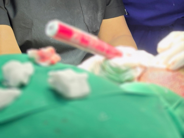 hair-transplant-surgeon-implanter-pen-implantation-training