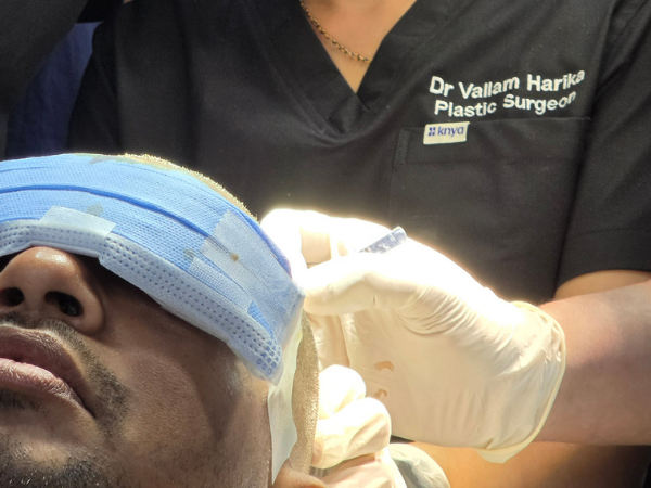 hair-transplant-surgeon-surgical-loupes-implantation-portrait