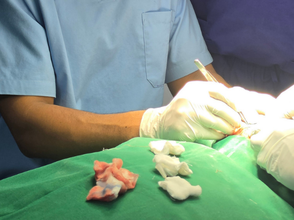 hair-transplant-workshop-hands-on-implantation