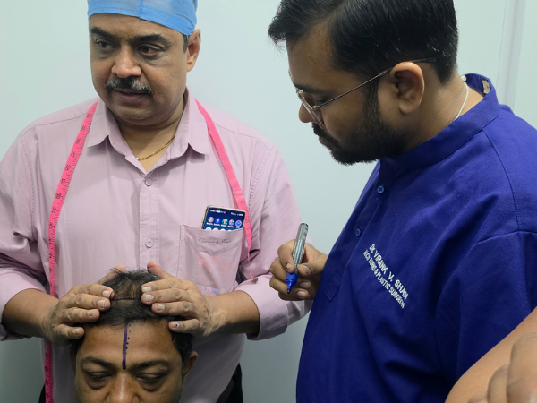 hair-transplant-workshop-treatment-planning