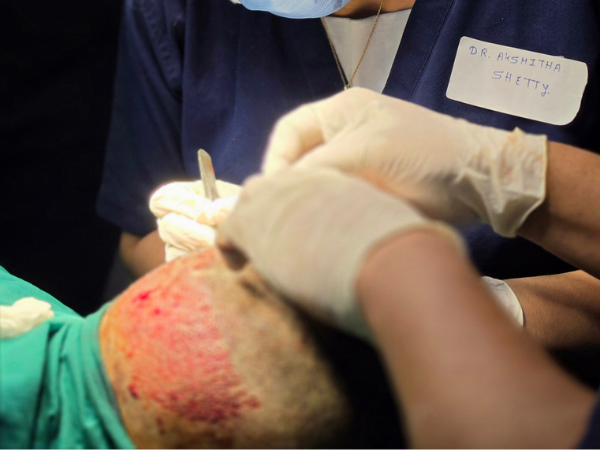 hairline-restoration-implantation-procedure-training