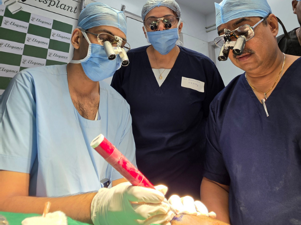 hairline-restoration-loupe-assisted-graft-placement