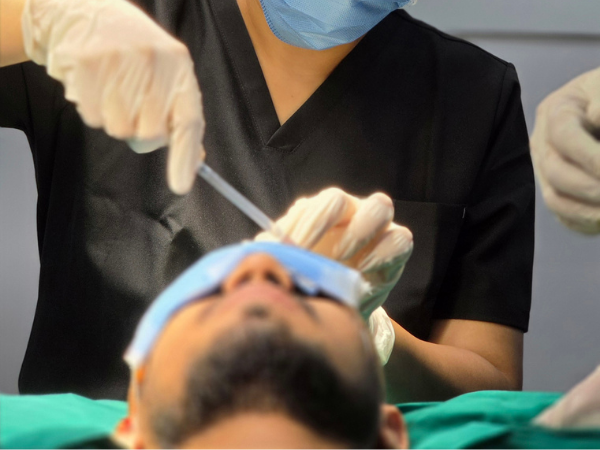 hairline-restoration-procedure-doctor-demonstration