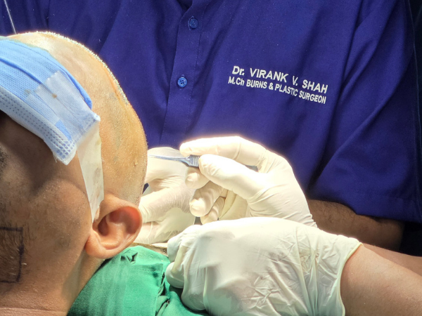 plastic-surgeon-hair-transplant-implantation-training-workshop