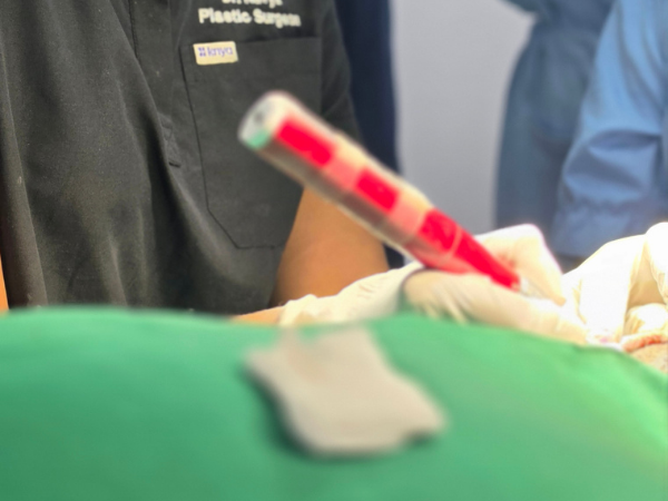 plastic-surgeon-hair-transplant-implanter-pen-workshop